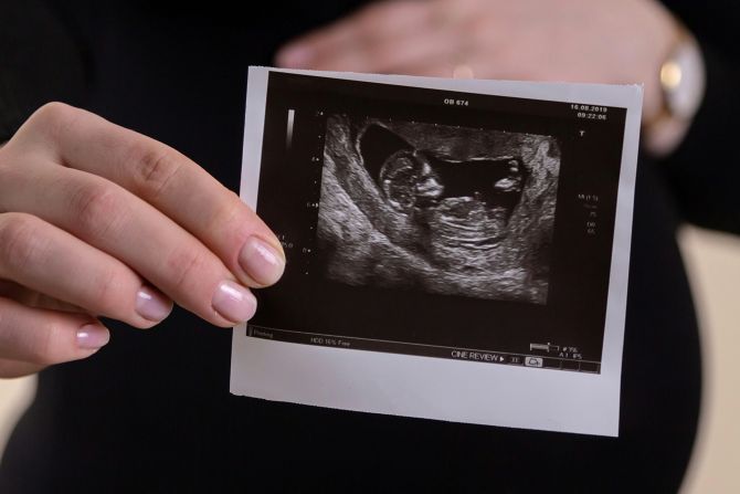 Obispos rechazan proyecto de ley que permitiría el aborto hasta casi los 5 meses de embarazo Noruega 2024