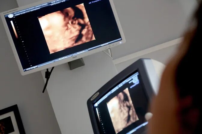 Anuncian ataque a la objeción de conciencia al aborto España 2024